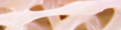 Porous PEEK Scaffolding